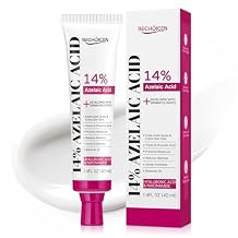 14% Azelaic Acid Acne Cream with Niacinamide & Centella,Azelaic Acid Facial Serum Smooth & Even Skin Tone,Reduce Appearance of Blemishes,Dark Spots & Post-Acne Marks,Gentle Hydrating Formula,1.4oz