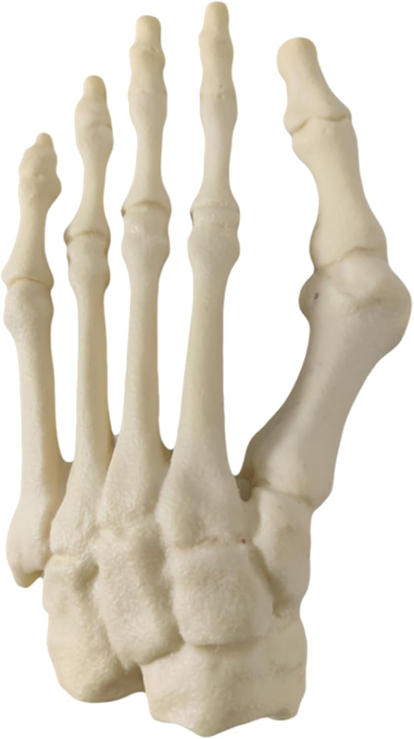 Human Foot Skeleton Model, Forefoot Hallux Valgus Deformity Model, For Medical Study & Science Classroom,Flesh,12Cm,Flesh,12cm