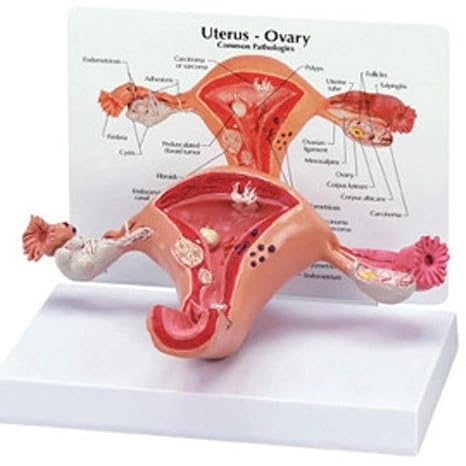 Pathological Uterus Ovary Anatomical Model Anatomy Cross Section Study Tool