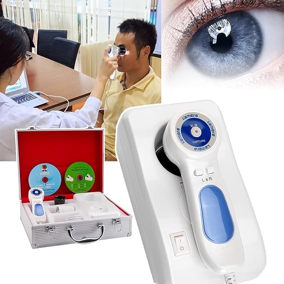 Multi-Function Iris Analyzer Iridology Camera, USB Computer-Specific Iris Analysis Camera, with Aluminum Box + Hd 13 Million Pixel + Iris Analysis Software, for Beauty Salon, Spa