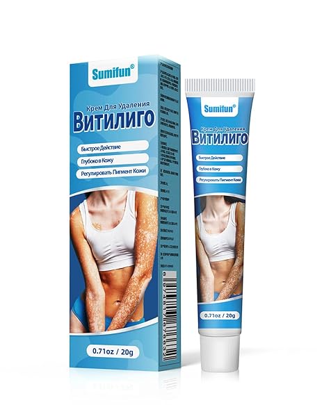 Vitiligo Cream Natural Plant Extracts Gently and Effectively Reduces White Spots Improves Pigmentation Repairs the Skin Barrier Suitable for All Skin Types 20 g