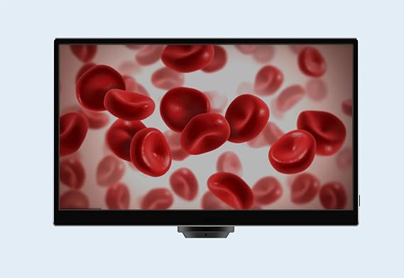 CX3 5.0MP HDMI Microscope Camera with 11.6-Inch TFT Display